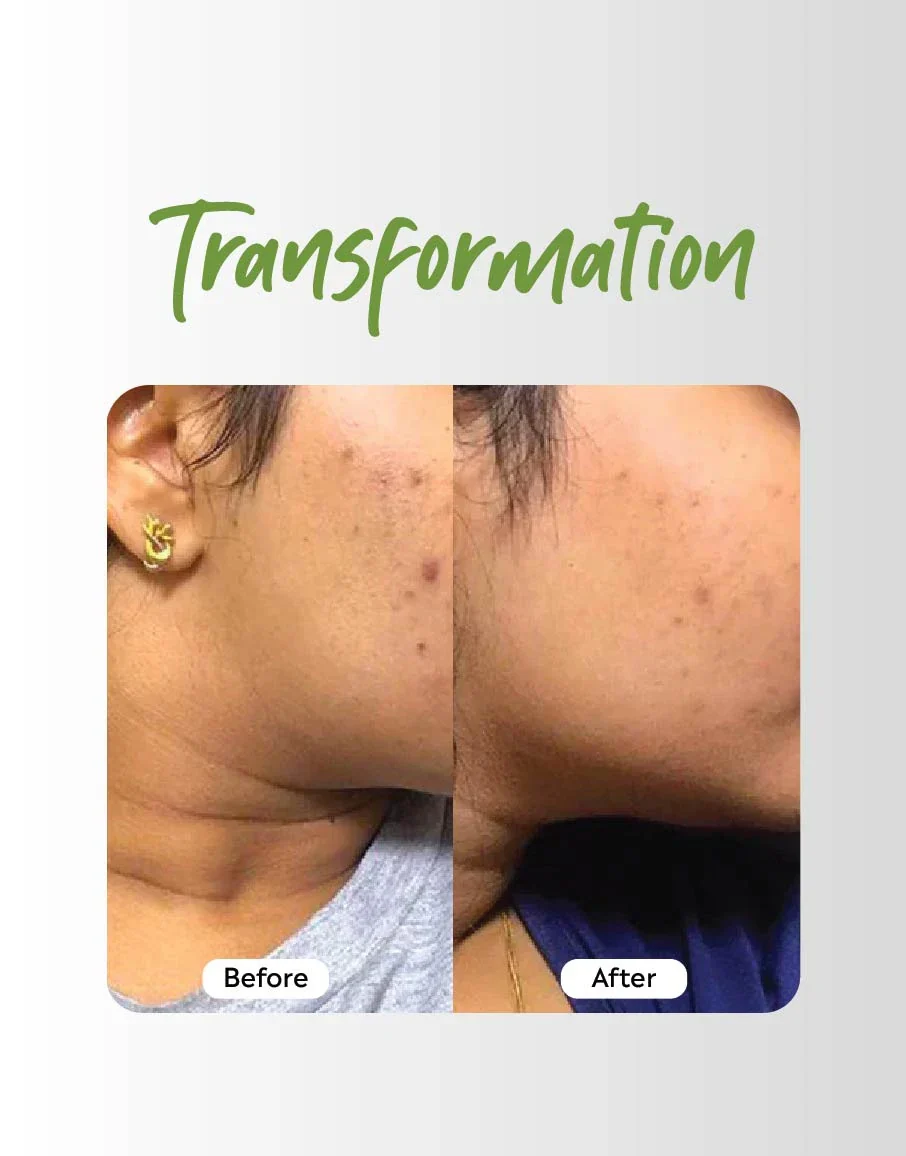 Clear Skin Combo - Image 3