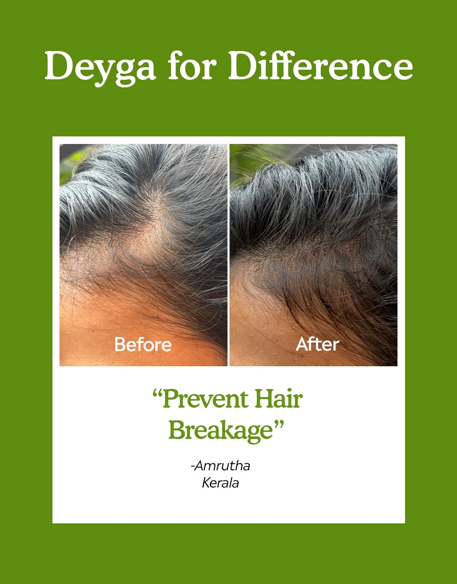 Hair Growth Oil - Image 4